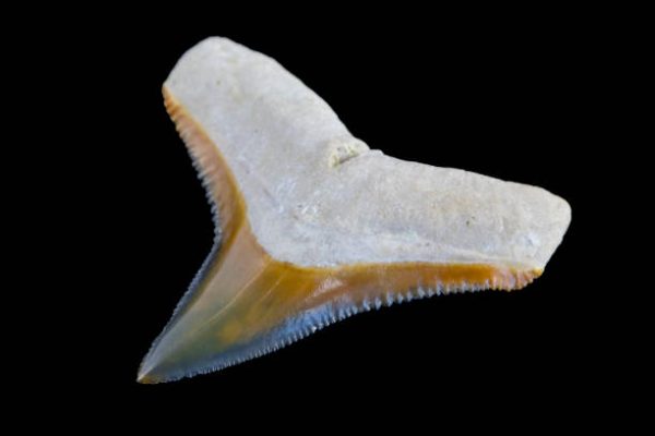 Bone vs Cartilage: Structural Basics